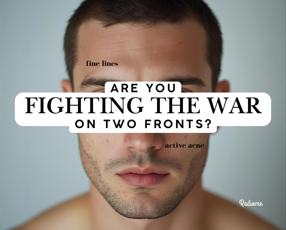 Still Getting Acne? You're Not Just Breaking Out, You're 'Stress-Aging'